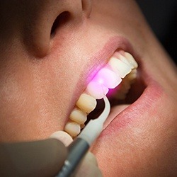 Closeup of patient receiving laser dental treatment
