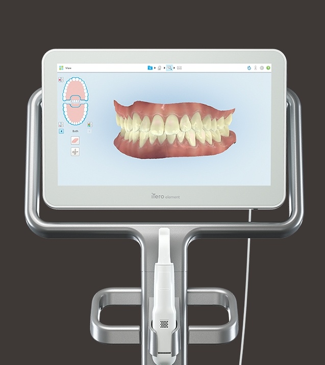 Digital impressions and smile design