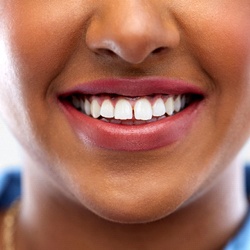 woman smile gapped teeth