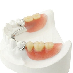 example of partial dentures