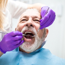An older man undergoing a regular dental checkup and cleaning after receiving dental implants to replace his missing teeth