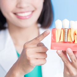 A dentist holding a mouth mold that contains a full dental implant situated between two healthy teeth