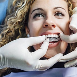 Young woman smiles while getting Invisalign