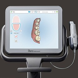 Image of the iTero 3D Scanner for Invisalign in Myrtle Beach