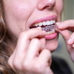 patient experiencing the comfort of Invisalign