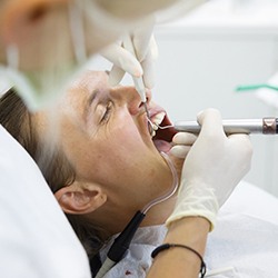 A dentist performing a root planing procedure on a patient with gum disease