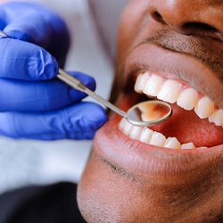 man getting a dental exam