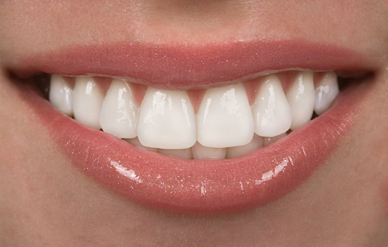 Invisalign in Myrtle Beach, Straight Teeth