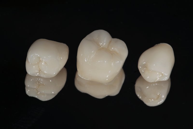 three different types of dental crowns all used to protect weakened teeth